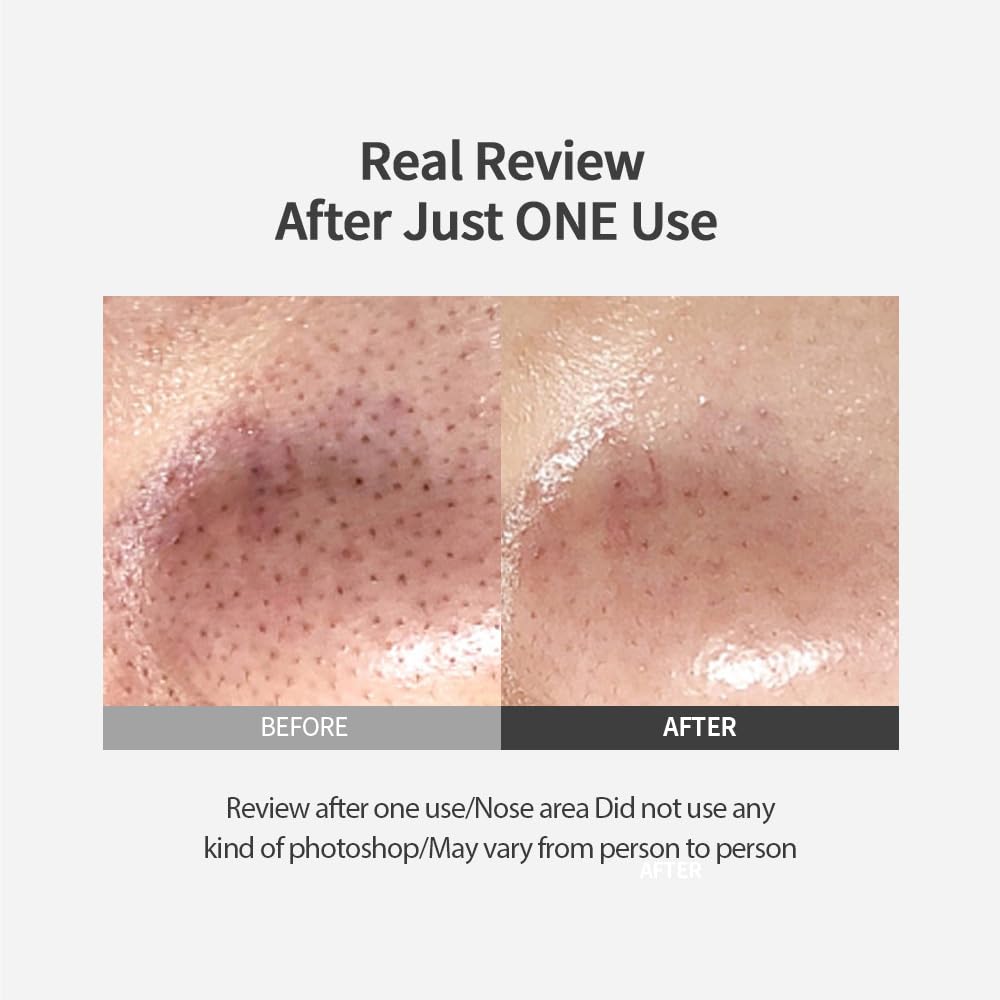 Blackhead Melting Clear Pad 65g(30 counts), Blackhead Remover Pad, Pore Minimizing, Deep Cleansing & Pore Unclogging