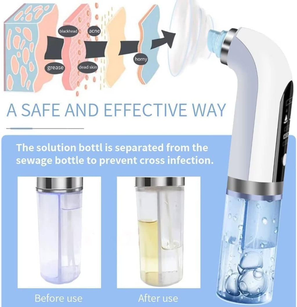 Hydrafacial Pore Vacuum Blackhead Remover Water Circulation Pore Cleaner Pimple Extractor Tools with 6 Suction