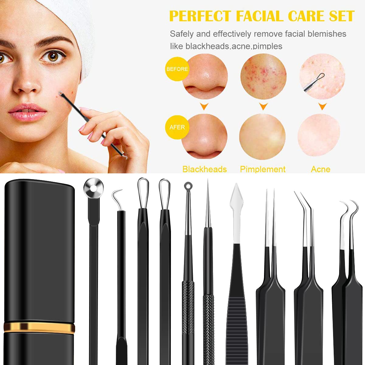 10Pcs Stainless Steel Pimple Popper Tool Kit, Blackhead Remover Tools Comedone Extractor Set, Acne Needle Tweezers