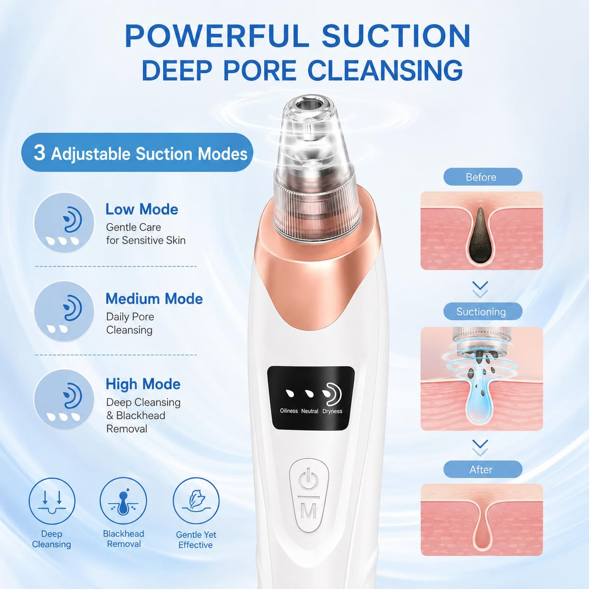 2026 Pore Vacuum, Rechargeable Blackhead Remover Vacuum Skincare - White