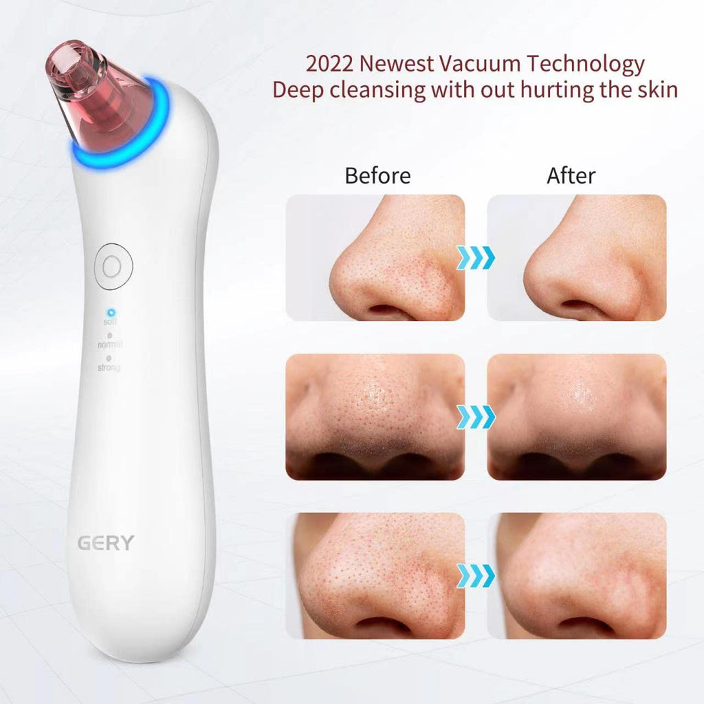 Blackhead Remover Pore Vacuum for Face Nose, Pimple Extractor Tools