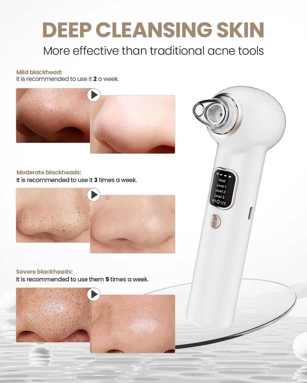 Heated Blackhead Remover Pore Vacuum with 5 Probes & 3 Suction Modes