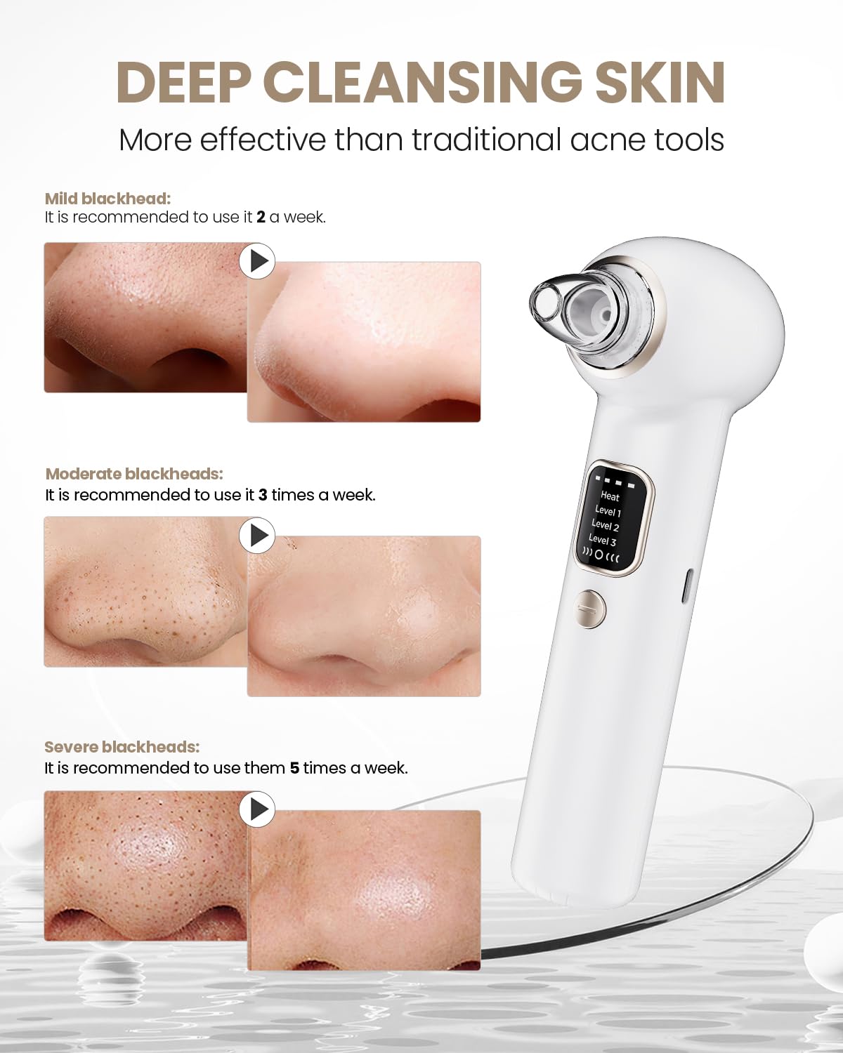 Heated Blackhead Remover Pore Vacuum with 5 Probes & 3 Suction Modes