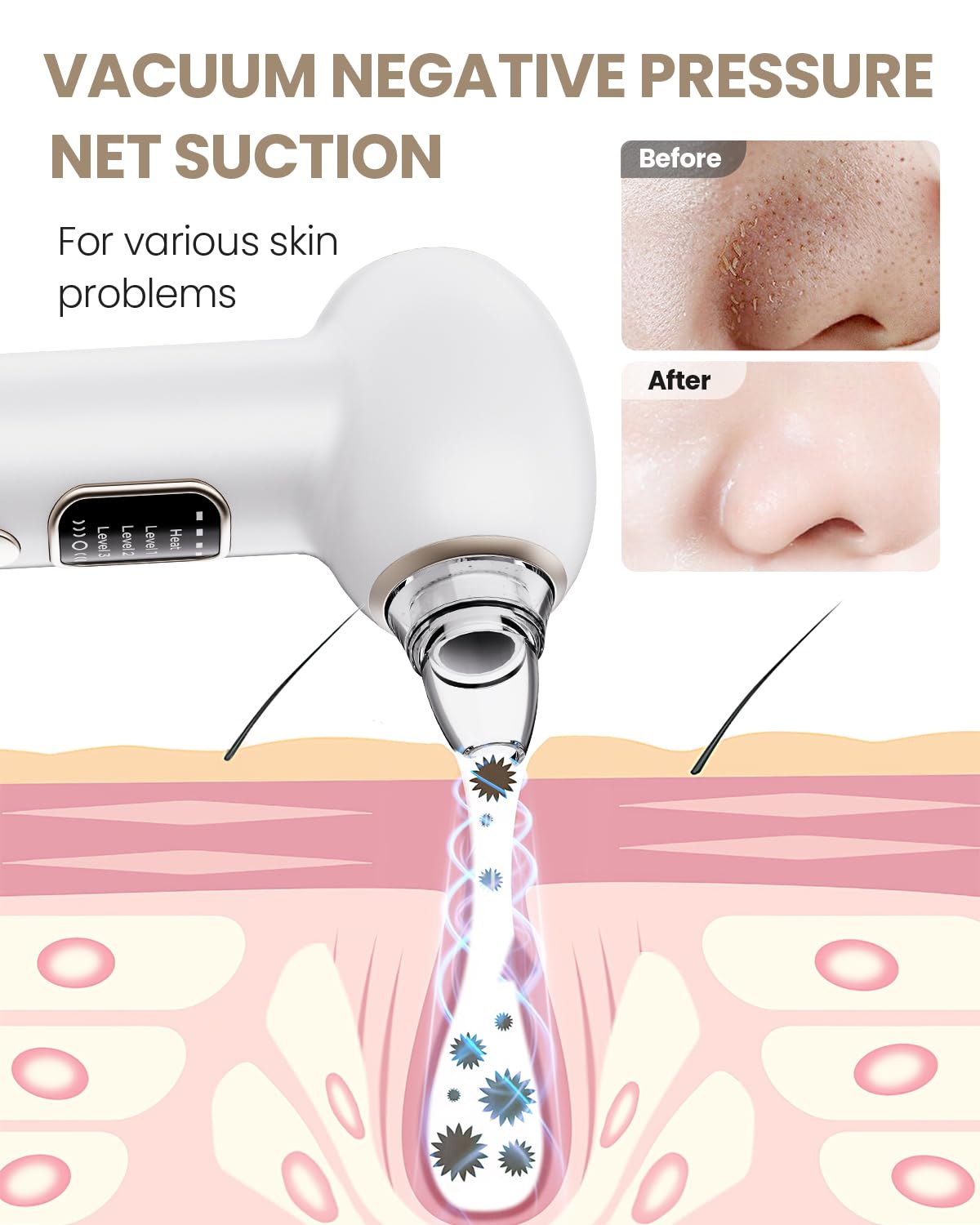 Heated Blackhead Remover Pore Vacuum with 5 Probes & 3 Suction Modes