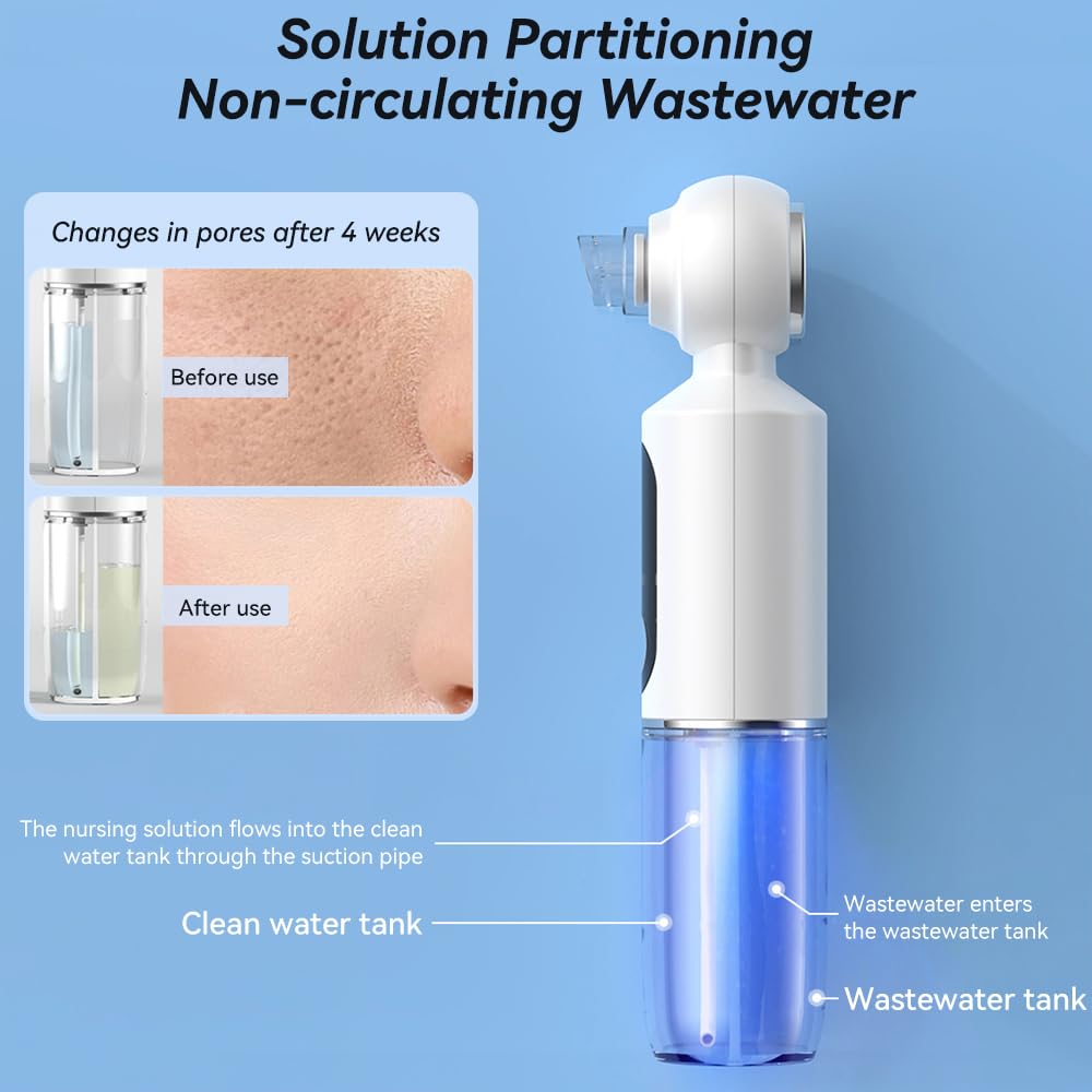Blackhead RBlackhead Remover Vacuumemover Vacuum, Pore Cleaner Suction Tool for Face