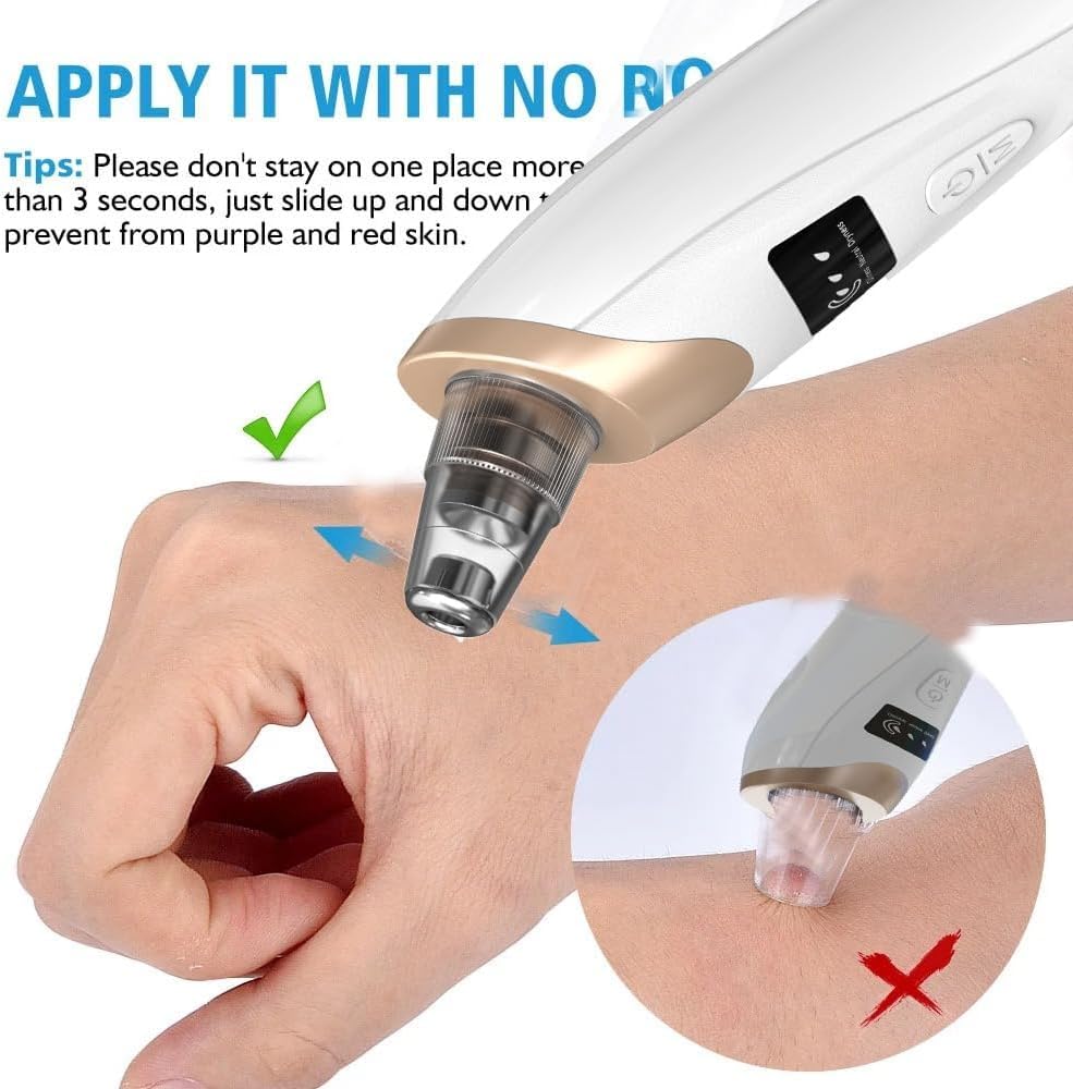Blackhead Remover Vacuum - Professional Blackhead Extractor for Face with 3 Adjustable Suction Levels, USB