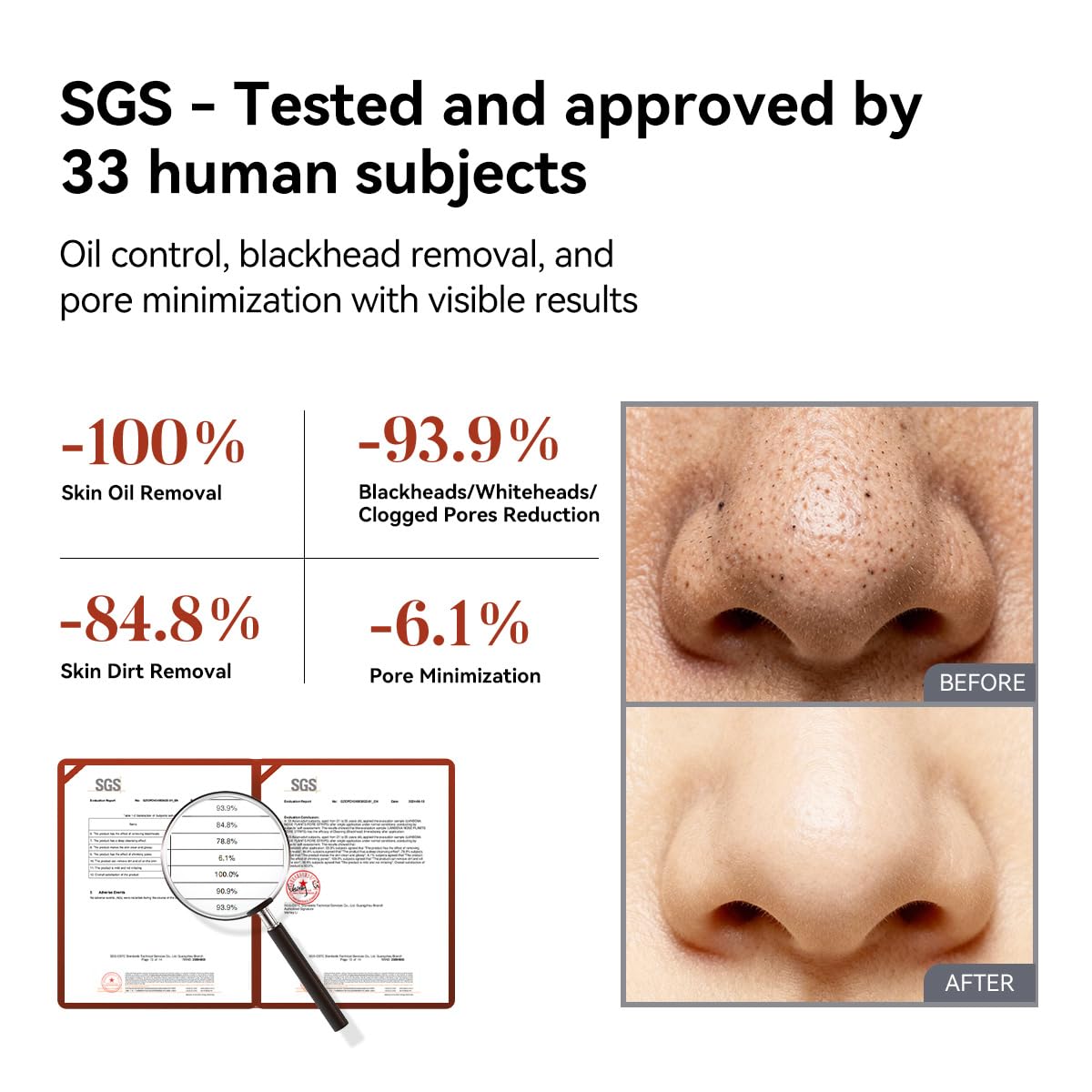 3-in-1 Blackhead Removal Set - Bamboo Charcoal Pore Strips (30g), Pore Minimizing Serum (15ml) & Removal Paper