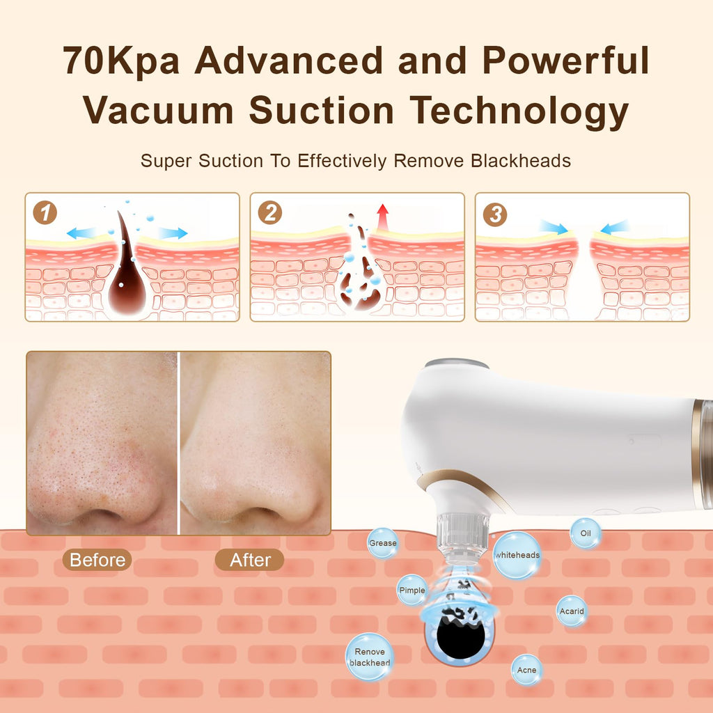 Blackhead Remover Pore Vacuum with Cold and Hot Compress, Pore Vacuum