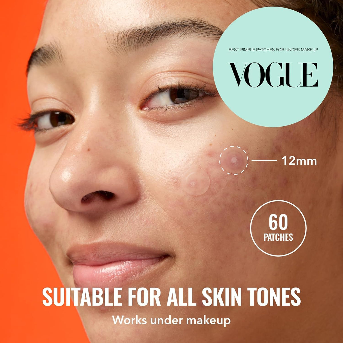 Pimple Patches for Face, 100 Pack – Ultra-Thin Hydrocolloid Patches, Invisible Under Makeup, Conceals Blemishes