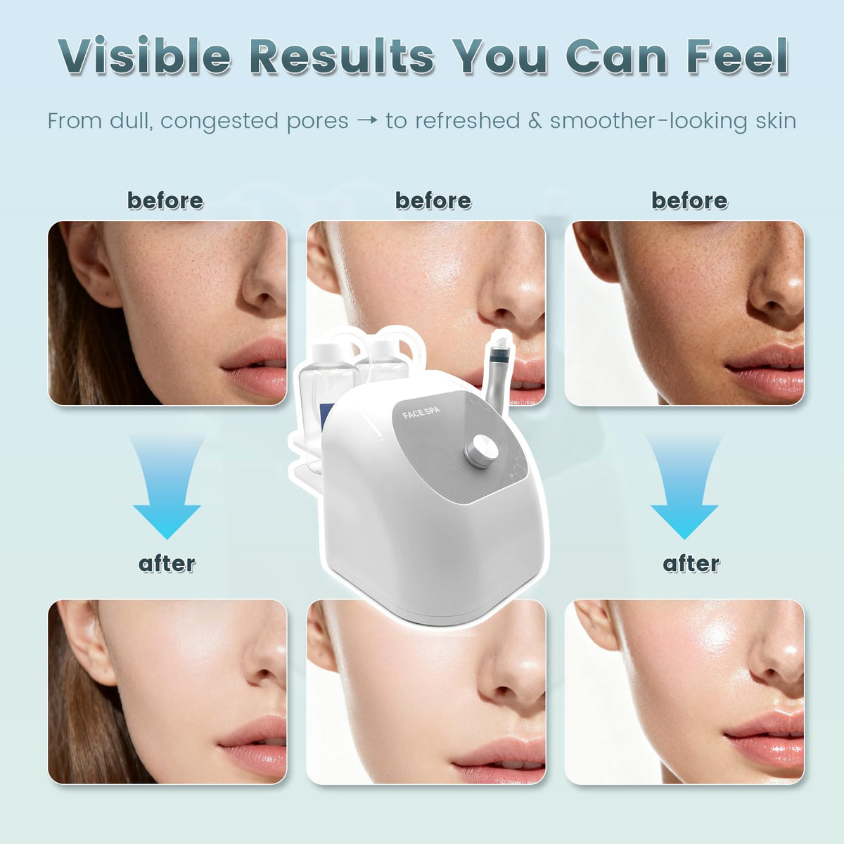 Hydrogen Oxygen Facial Machine, Hydro Facial Machine & Hydrodermabrasion Machine for Skin Care, Facial Vacuum Pore