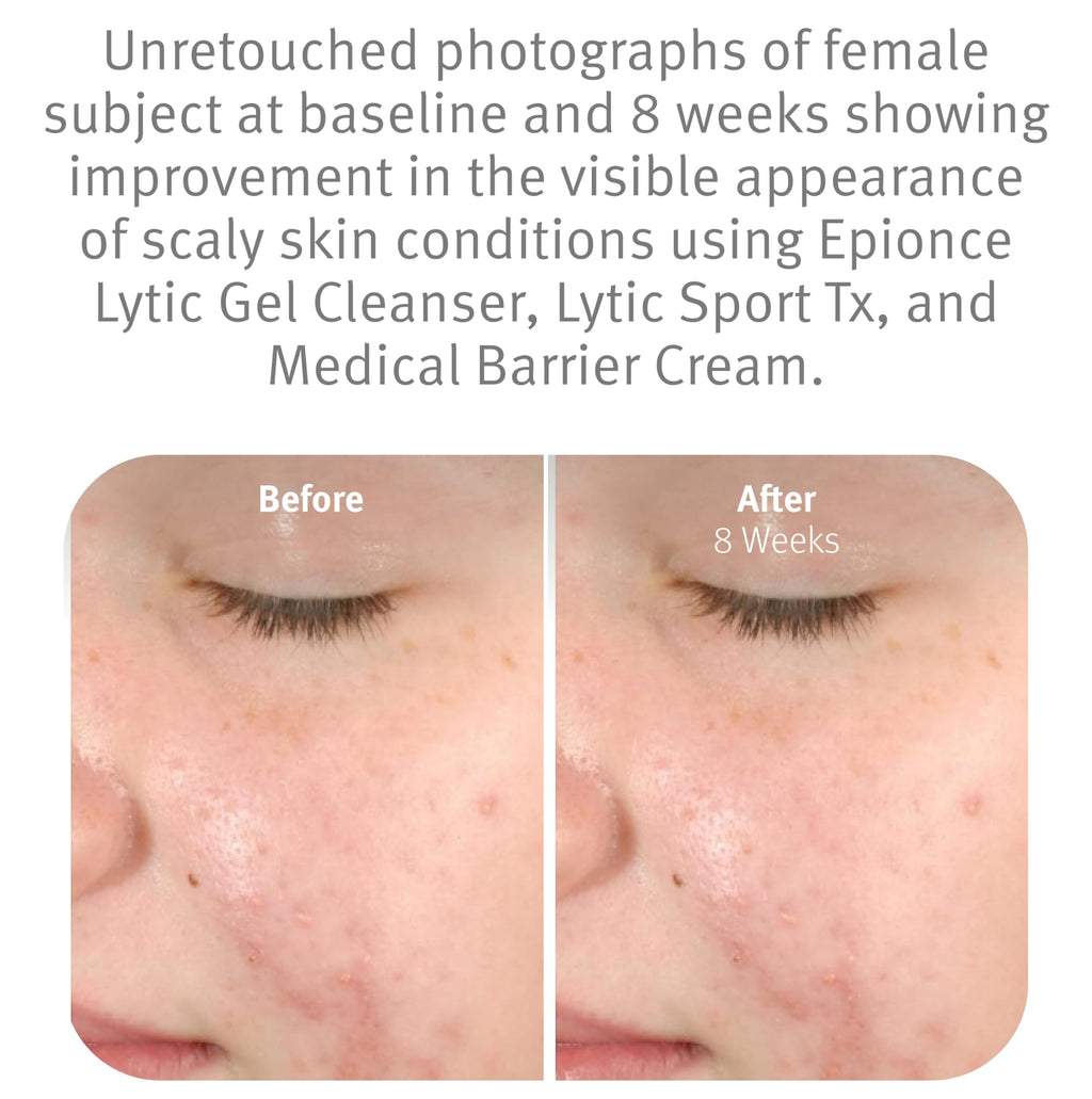 Lytic Gel Cleanser Gentle Foaming Face Wash Blemish Makeup Remover
