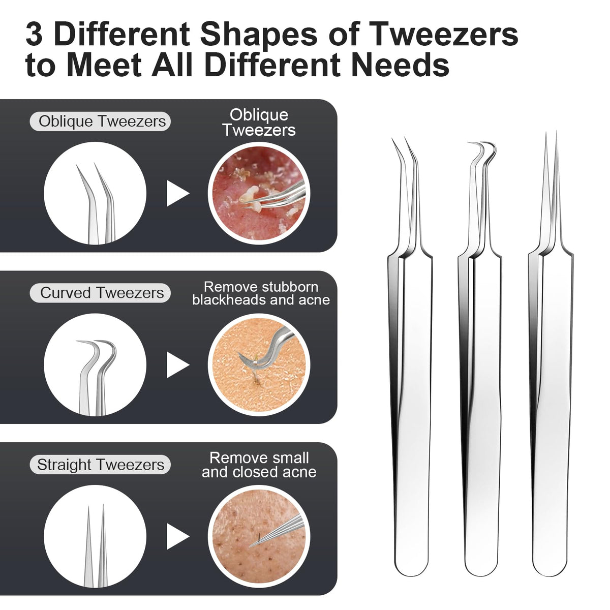 11Pcs Blackhead Remover Kit, Stainless Steel Acne Comedone Extractor with 10X Magnifying Glass & 20 75% Alcohol Pads
