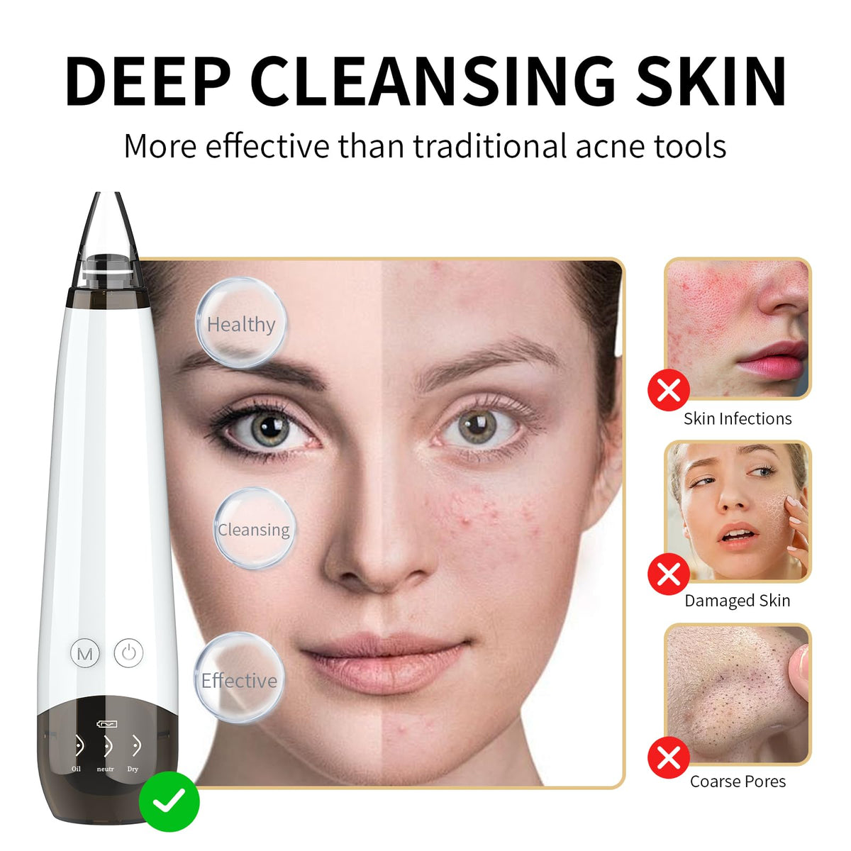 2026 Blackhead Remover Pore Vacuum Cleaner - 3 Adjustable Suction Power 6 Probes,USB Rechargeable Blackhead Vacuum
