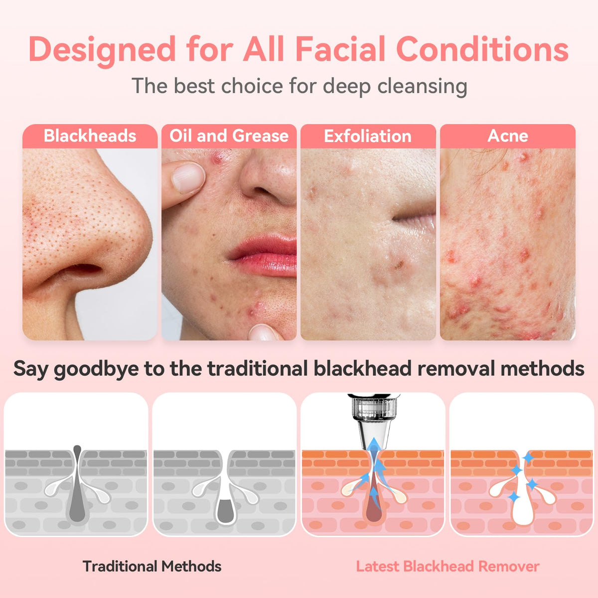 Blackhead Remover Pore Vacuum, USB Rechargeable Face Pore Cleaner Tool