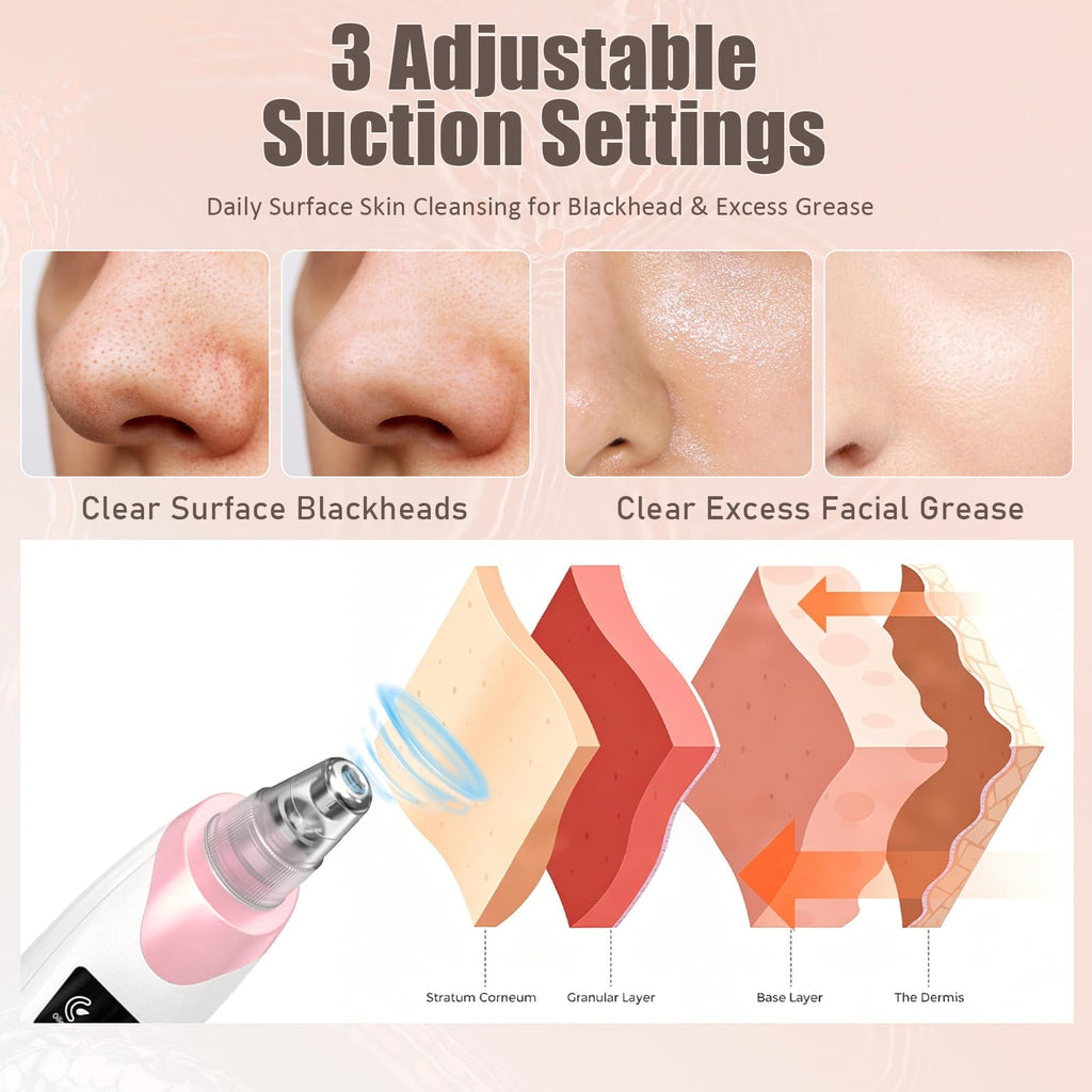 Blackhead Remover Pore Vacuum,Facial Pore Cleaner Blackhead Vacuum (Pink)