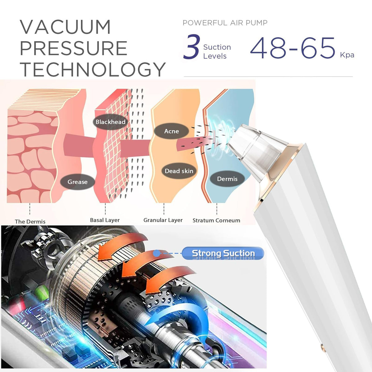 Blackhead Remover Pore Vacuum, Upgraded USB Rechargeable Facial Pore Cleaner Blackhead Removal Kit with 3 Suction