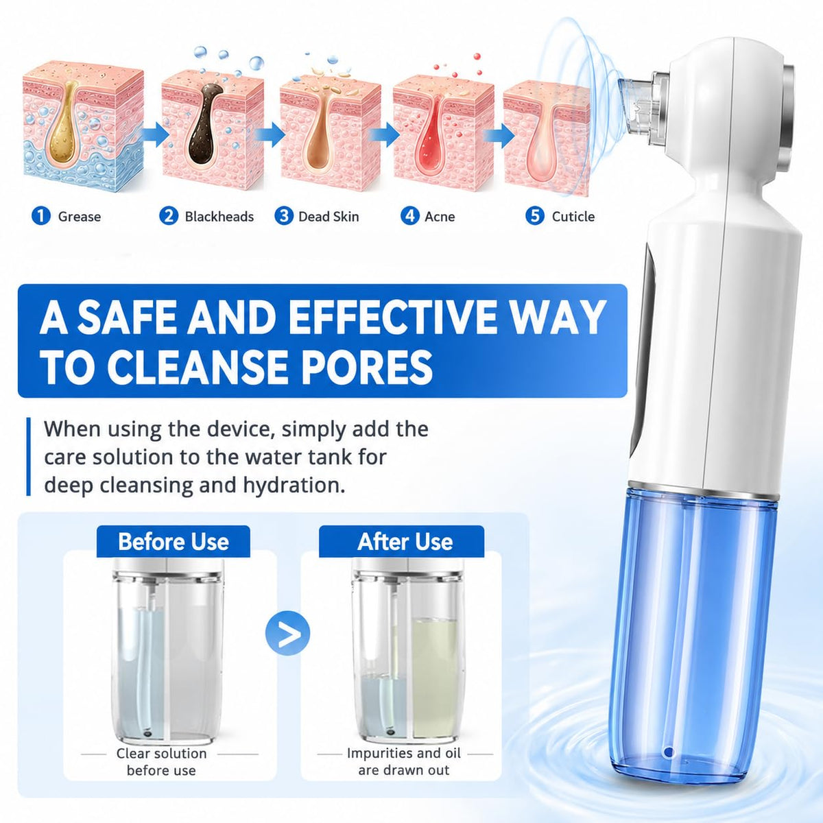 Blackhead Remover Suction Pore Vacuum Pore Hot Compress
