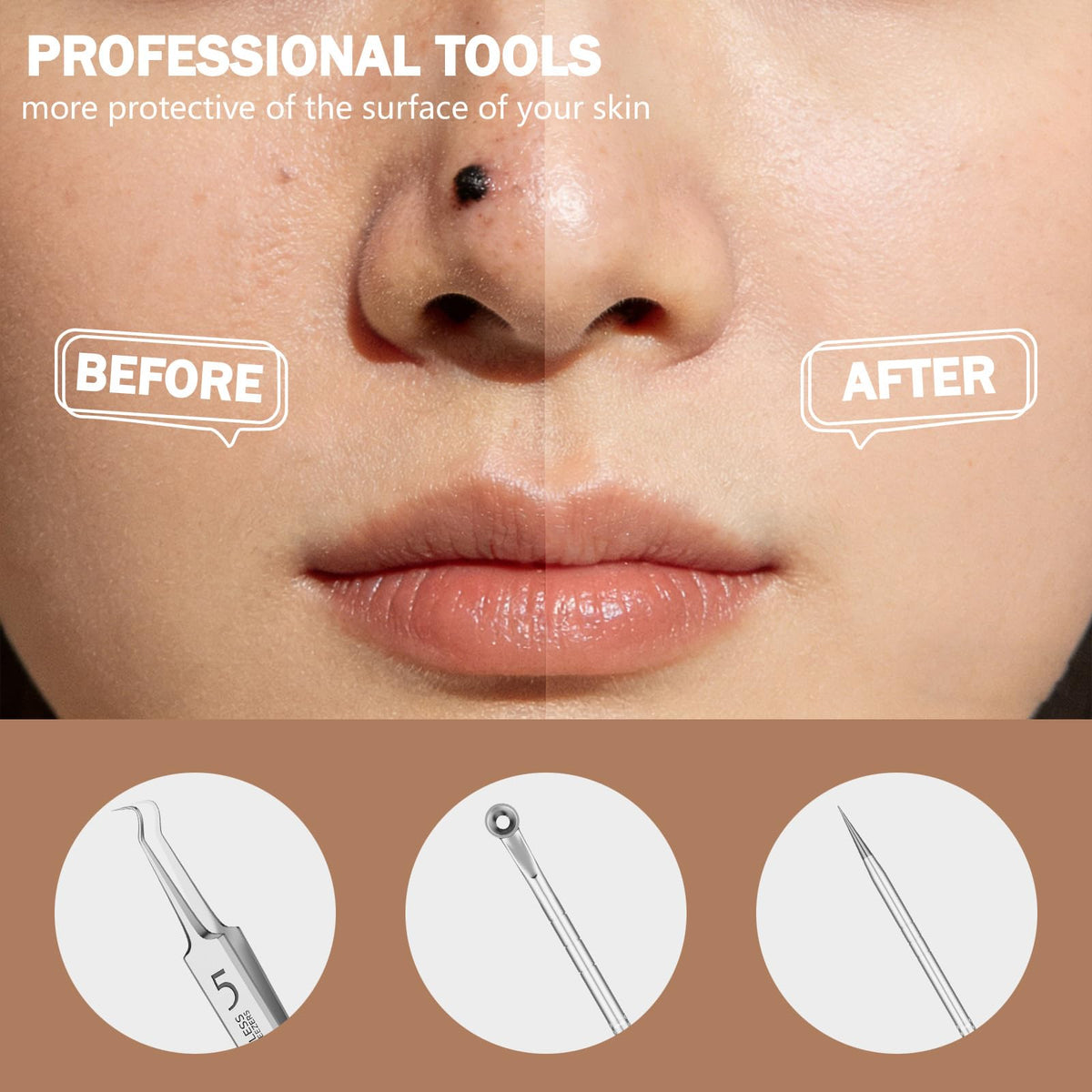 Blackhead Remover Pimple Popper Tool Kit 6 Pcs Blackhead Remover Tools Kit with Storage Case Pimple Popper Tool kit