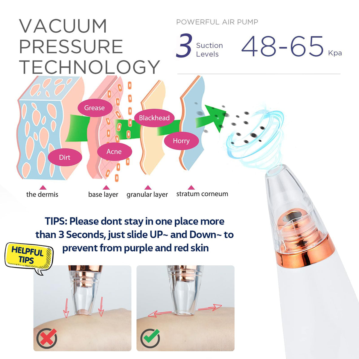 Blackhead Remover Vacuum, Black Head Remover for Face, Blackhead Extractor with 3 Suction Power, 6 Suction Probes, 4