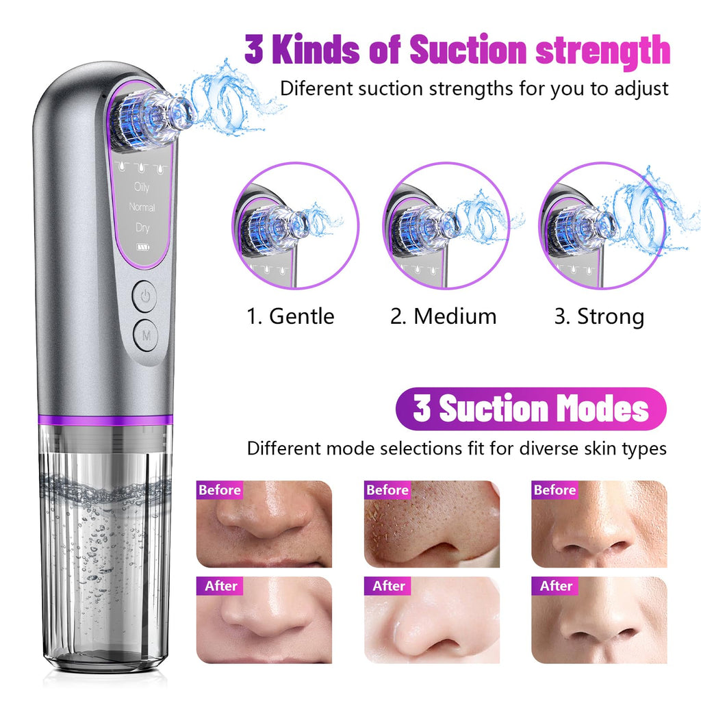 Blackhead Remover Vacuum, Electric Pore Cleaner, 3 Suction Levels, 5 Heads