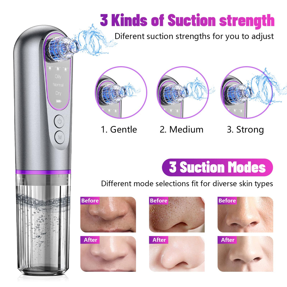 Blackhead Remover Vacuum, Electric Pore Cleaner, 3 Suction Levels, 5 Heads