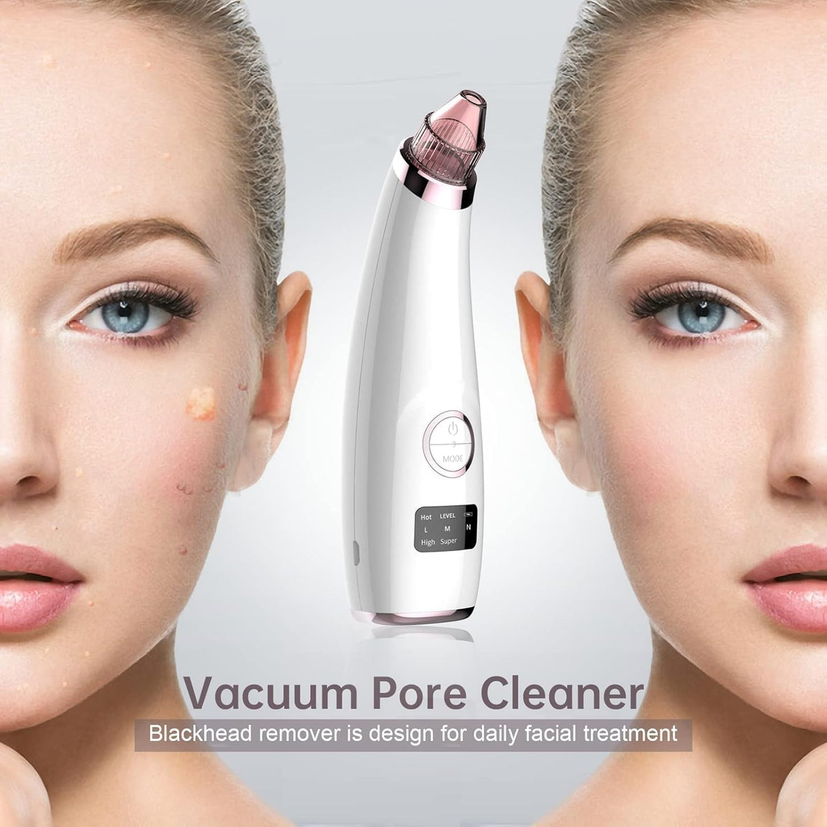 Blackhead Remover Vacuum, Rechargeable Pore Cleaner