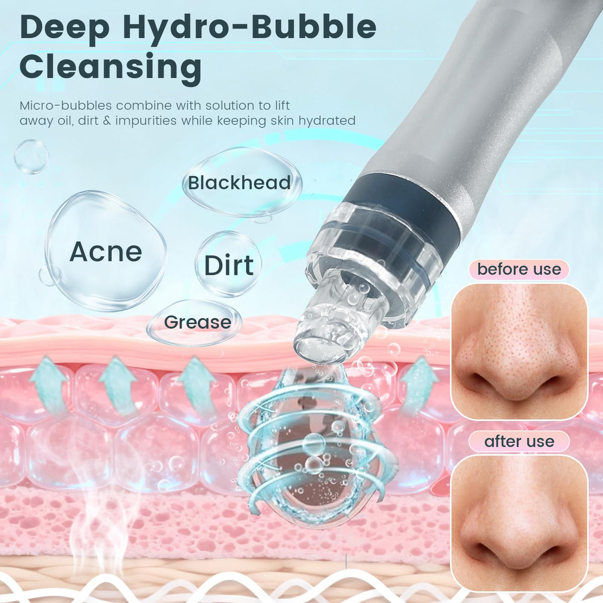 Hydrogen Oxygen Facial Machine, Hydro Facial Machine & Hydrodermabrasion Machine for Skin Care, Facial Vacuum Pore