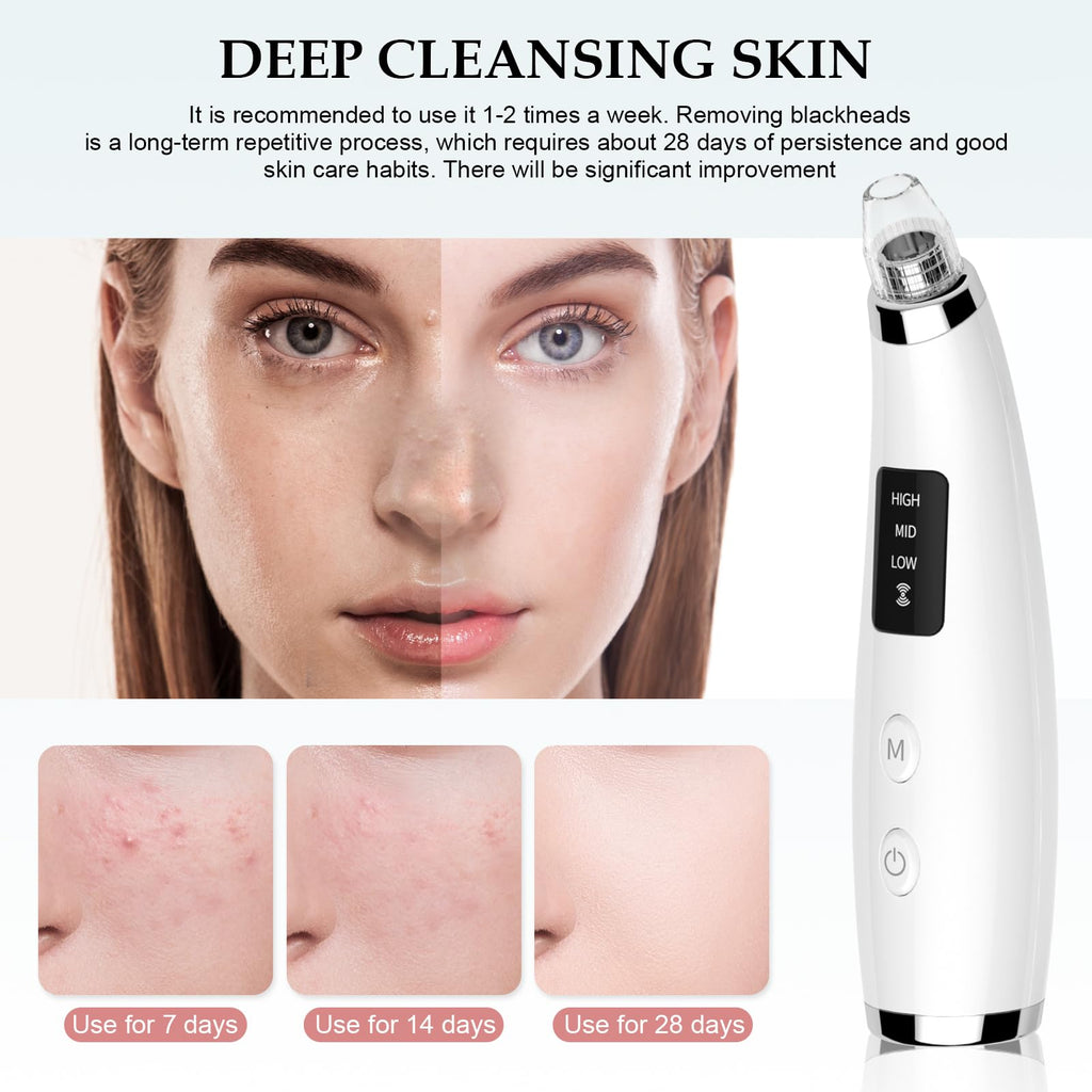 Blackhead Remover Pore Vacuum with 5 Attachments, 3 Suction Levels (White)
