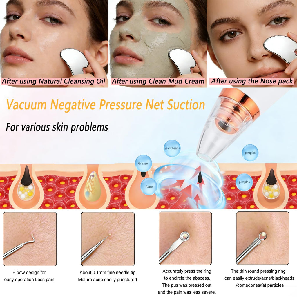 Blackhead Remover Vacuum, Black Head Remover for Face, Blackhead Extractor with 3 Suction Power, 6 Suction Probes, 4