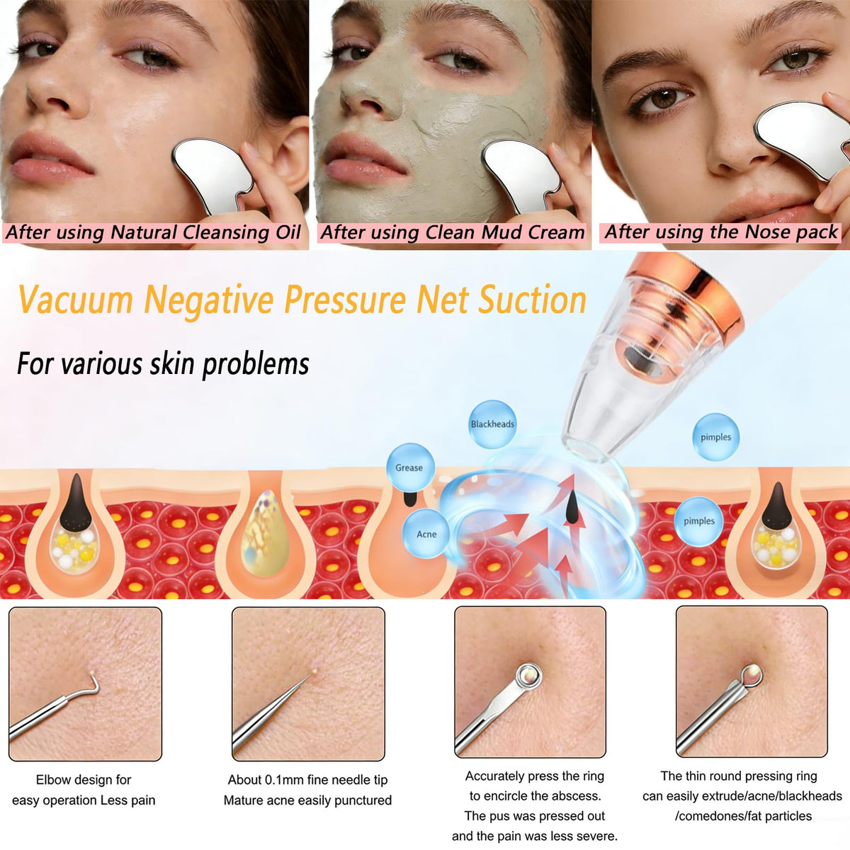 Blackhead Remover Vacuum, Black Head Remover for Face, Blackhead Extractor with 3 Suction Power, 6 Suction Probes, 4