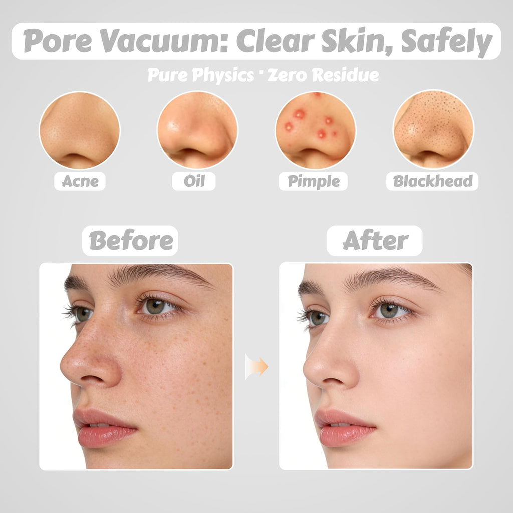 Pore Vacuum for Face & Nose - Blackhead Remover with 3 Adjustable Suction Levels, 6 Interchangeable Probes, USB-C