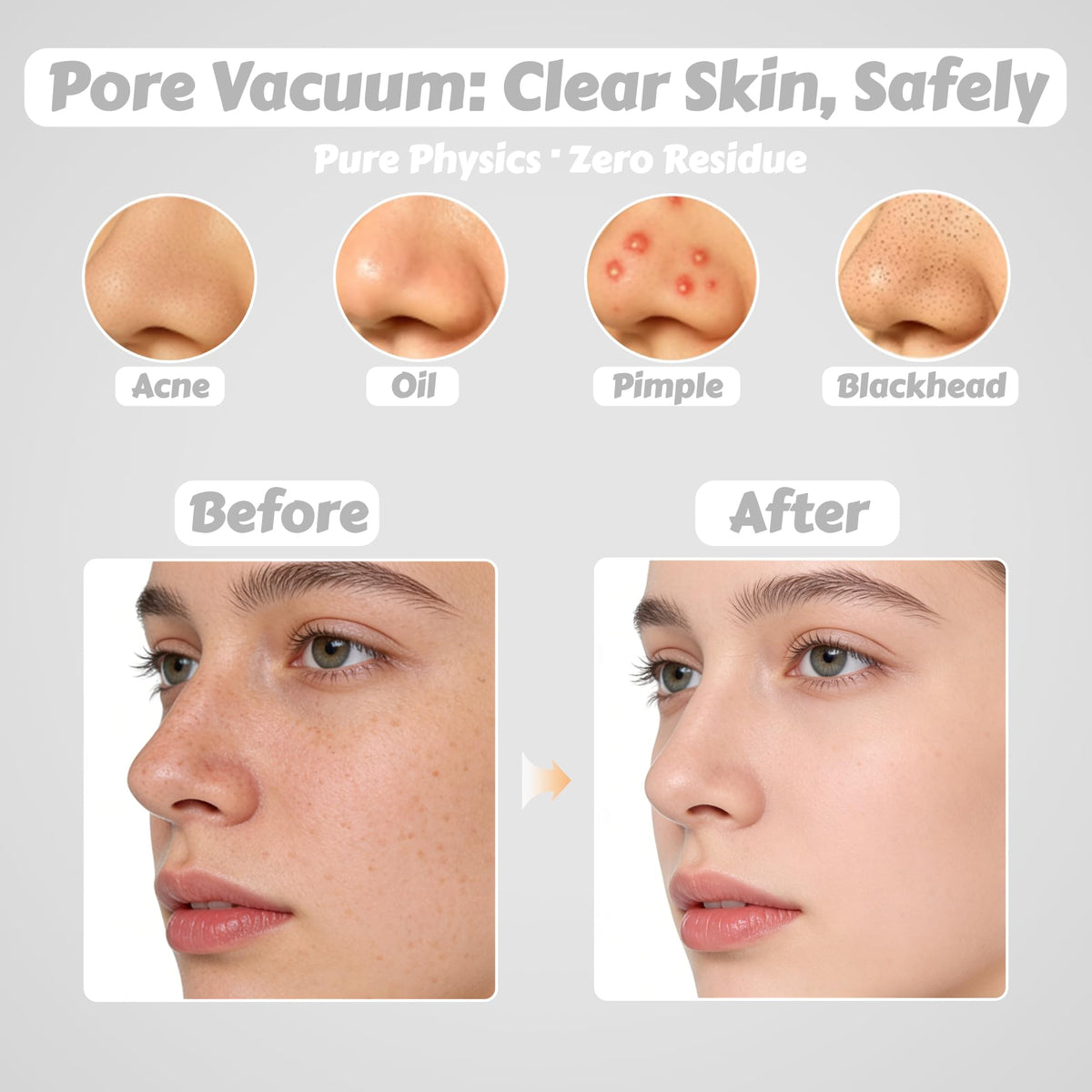 Pore Vacuum for Face & Nose - Blackhead Remover with 3 Adjustable Suction Levels, 6 Interchangeable Probes, USB-C