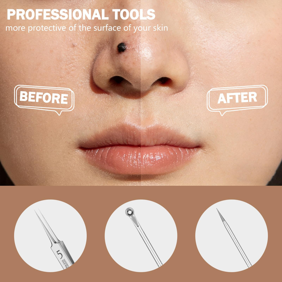 Blackhead Remover Pimple Popper Tool Kit 6 Pcs Blackhead Remover Tools Kit with Storage Case Pimple Popper Tool kit