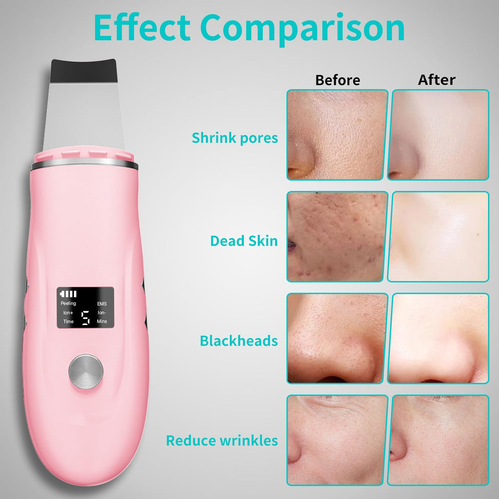 Face Scrubber Skin Spatula - Blackhead Remover Deep Cleansing Tool for Pore Extraction, 4-in-1 Fast Charging Dock