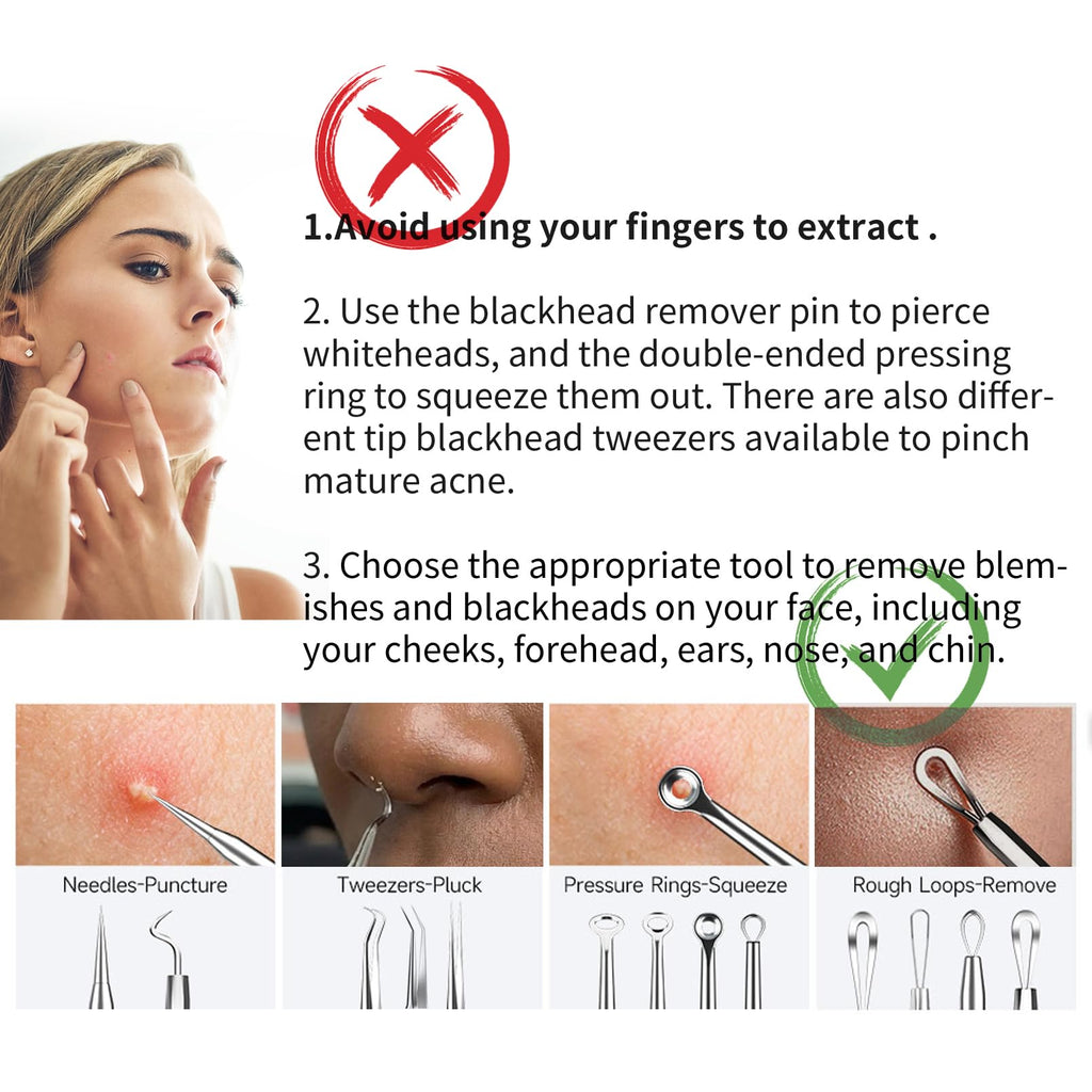 Pimple Popper Tool, Blackhead Remover Acne and Zit Comedone Extractor Kit