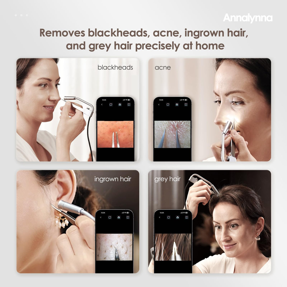 Visual Blackhead Remover Tweezers with Camera, 20x Magnification-Annalynna