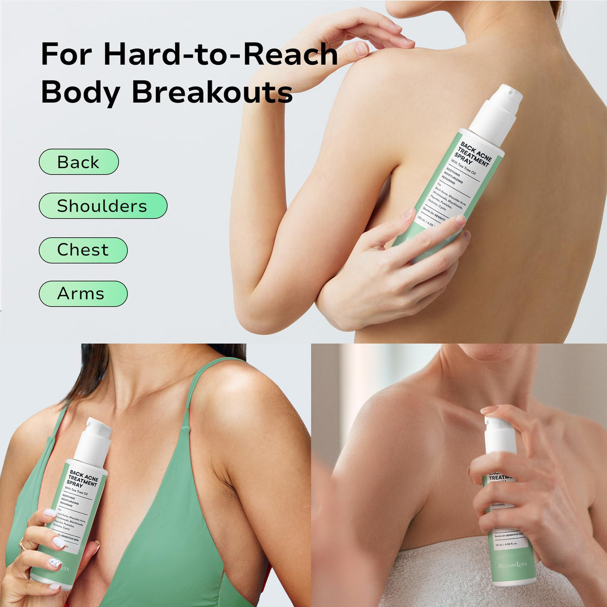Back & Body Acne Treatment: 2% Salicylic Acid Back Acne Spray for Clear, Soothe & Moisturize - Effective Bacne