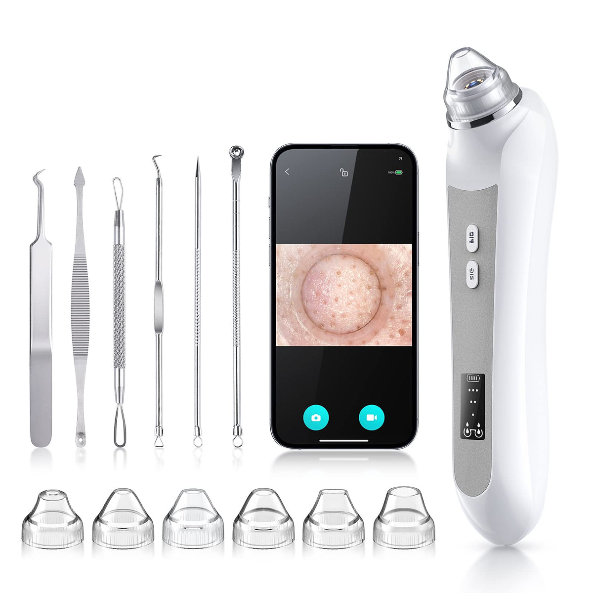 HD Camera USB Blackhead Remover Vacuum, 3 Modes 6 Suction Heads