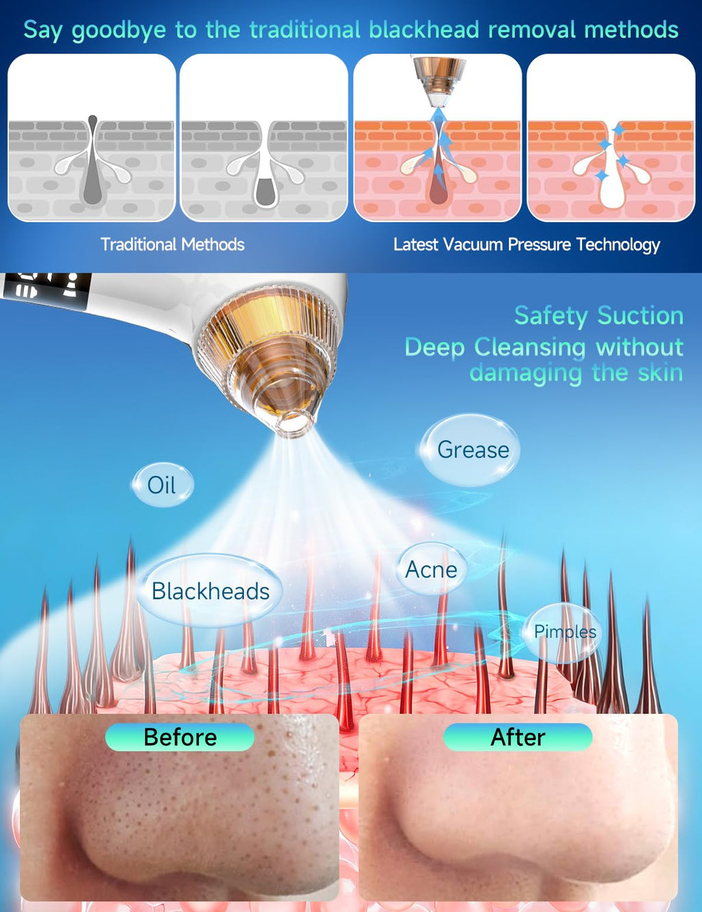 Upgraded Visible Blackhead Remover Pore Vacuum,5 Suction Levels,6 Probes