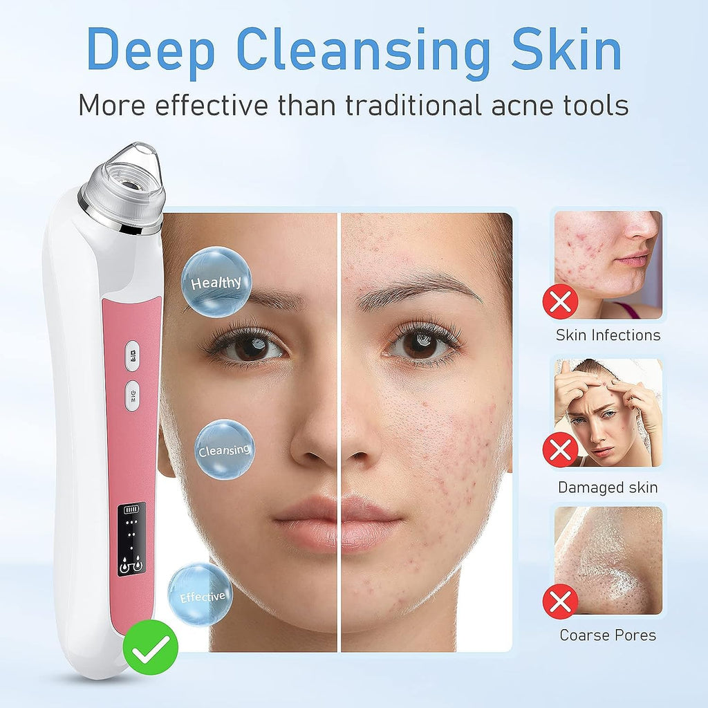 Blackhead Remover with Camera, 3 Levels, 6 Heads, USB Rechargeable
