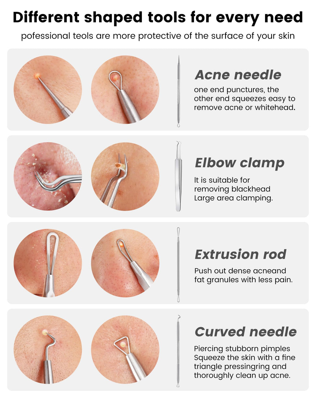 Pimple Popper Tool Kit - Boxoyx 6 Pcs Pore Prep Blackhead Remover Comedone Extractor Kit with Box for Quick and Easy