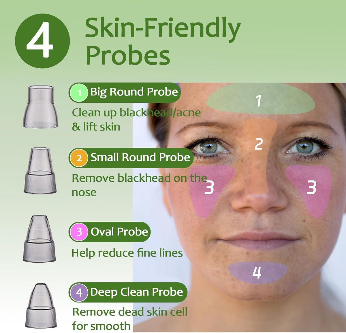 Blackhead Remover Pore Vacuum with 4 Probes, 3 Suction Levels, White