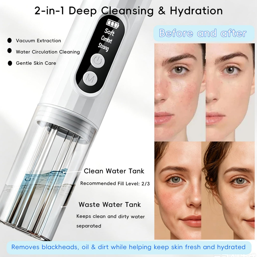 Blackhead Remover Vacuum, Microbubble Pore Cleaner, 3 Suction Levels