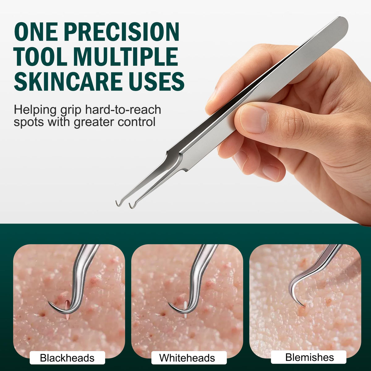 Blackhead Remover Tweezers, Professional Extraction Tools, Precision Angled Tip Comedone Extractor for Acne, Pimple &
