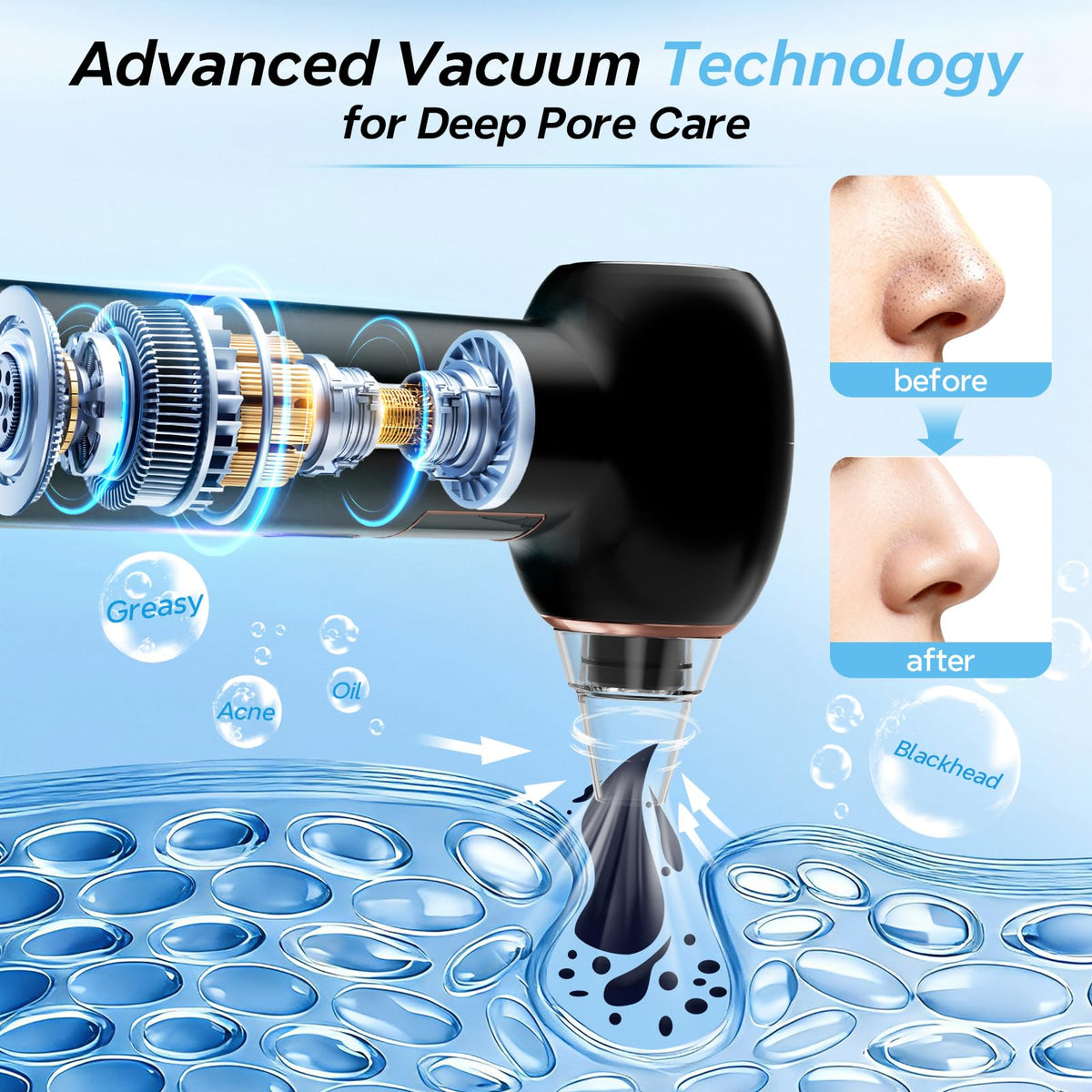 Blackhead Remover 3+1 Suction Modes Facial Pore Vacuum Cleaner (Black)