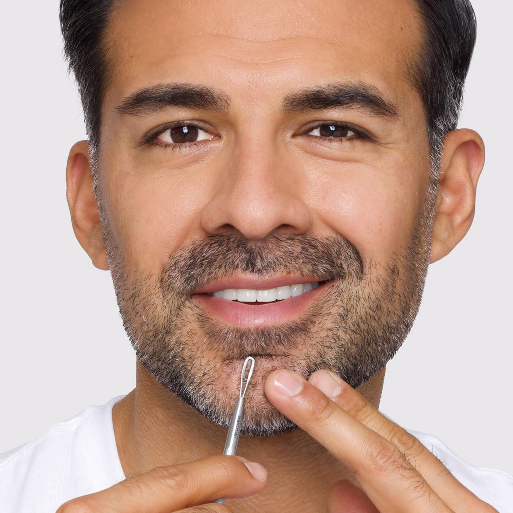 Whitehead and Blackhead Remover Stainless Steel