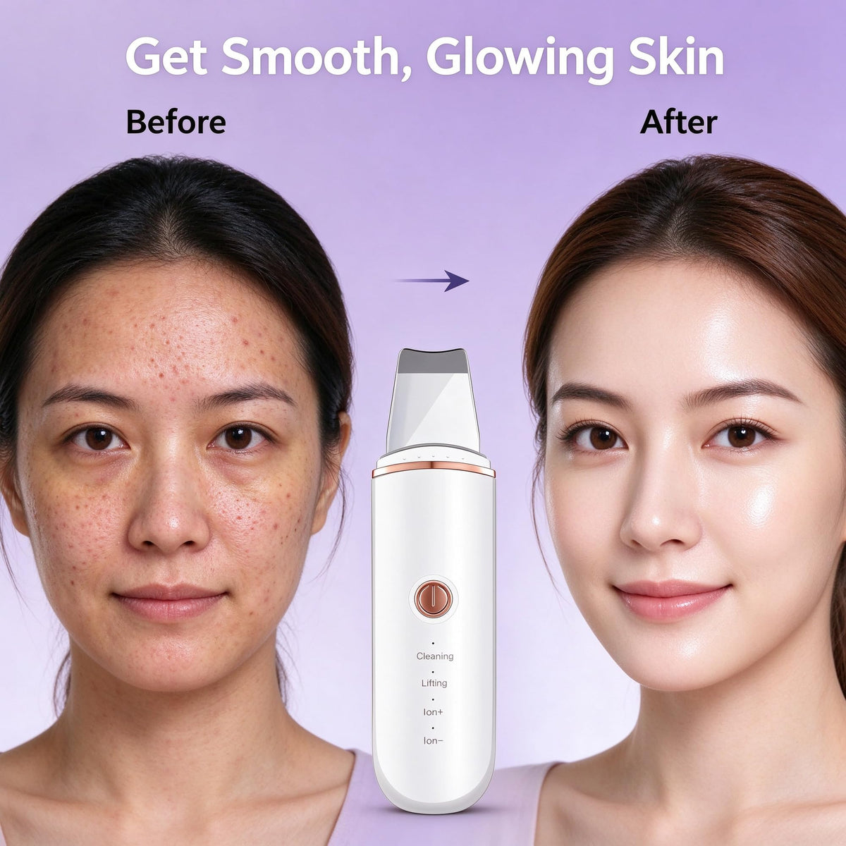 Skin Scrubber Face Skin Spatula Blackhead Remover Cleaner Skin Scraper with 4 Modes