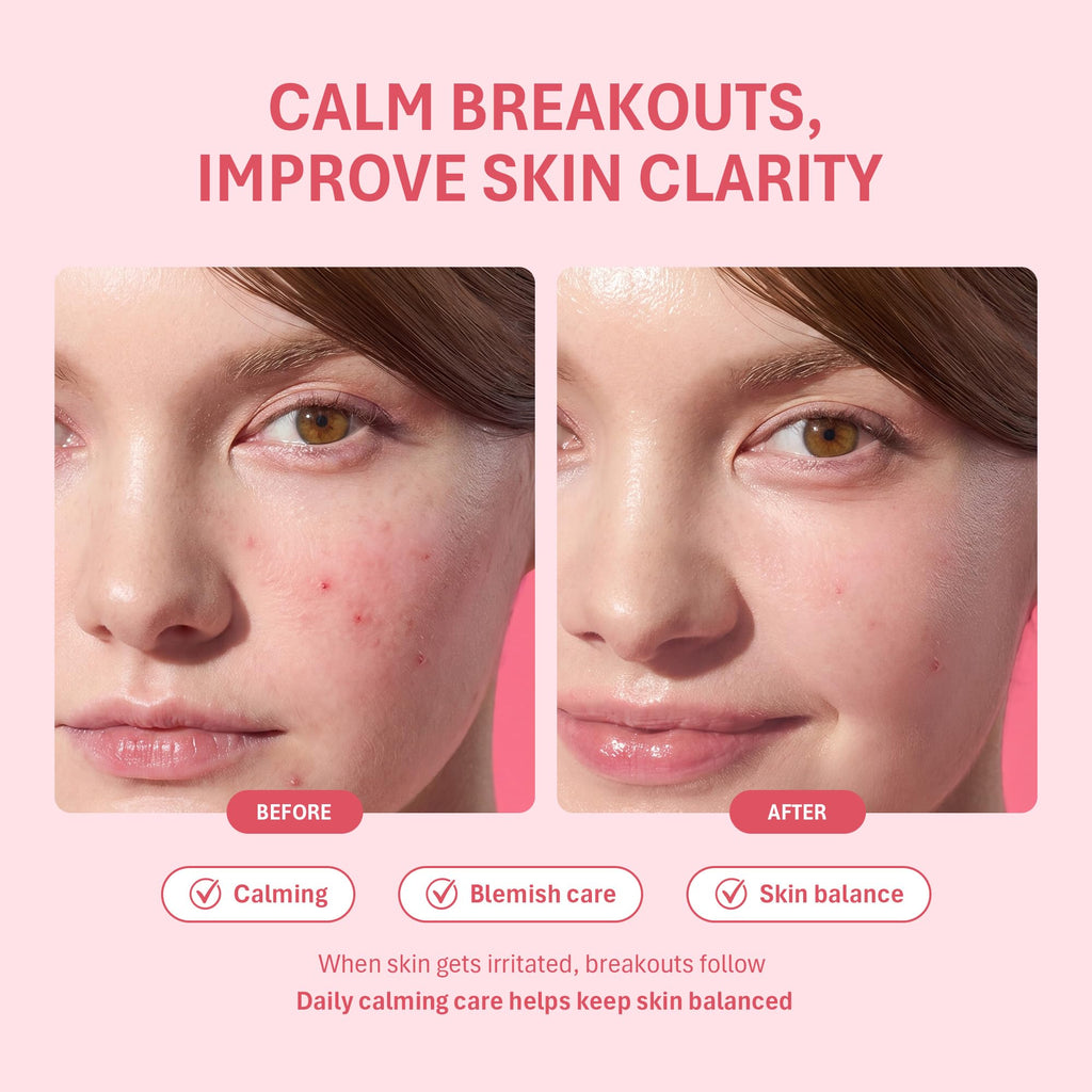 Salicylic Acid Acne Spot Treatment for Face, 0.67 fl.oz.