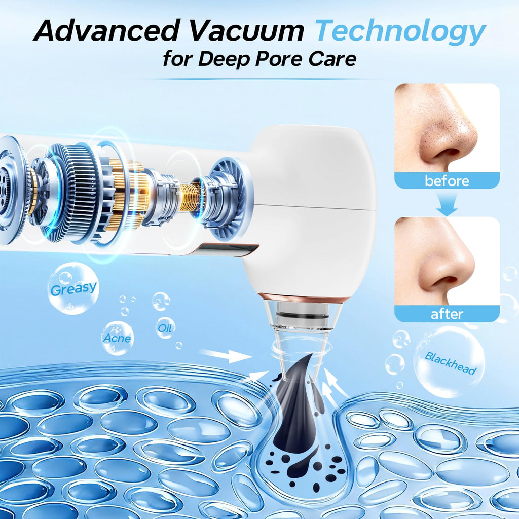 Blackhead Remover Tool 3 Suction Levels Facial Pore Vacuum Cleaner