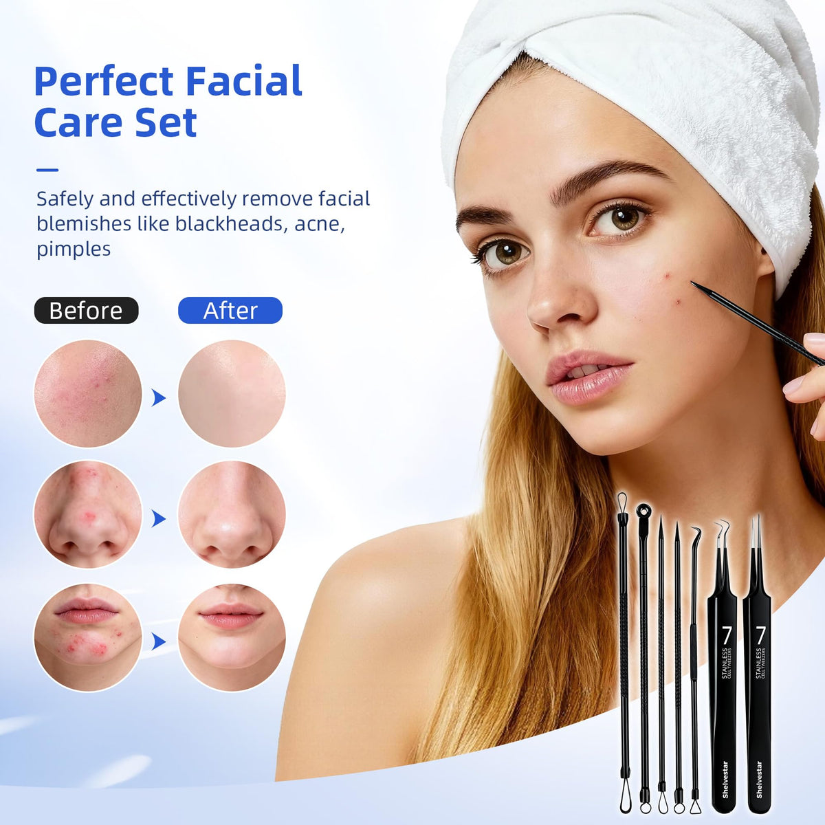 Blackhead Remover Tool Pimple Extractor Acne Removal Kit, Black